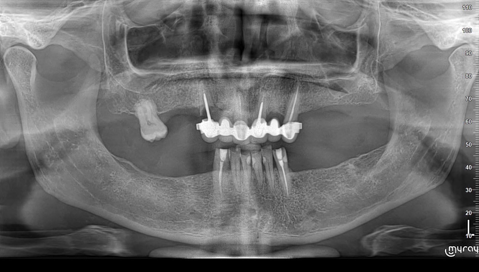 Cas 2 Intraoral Before
