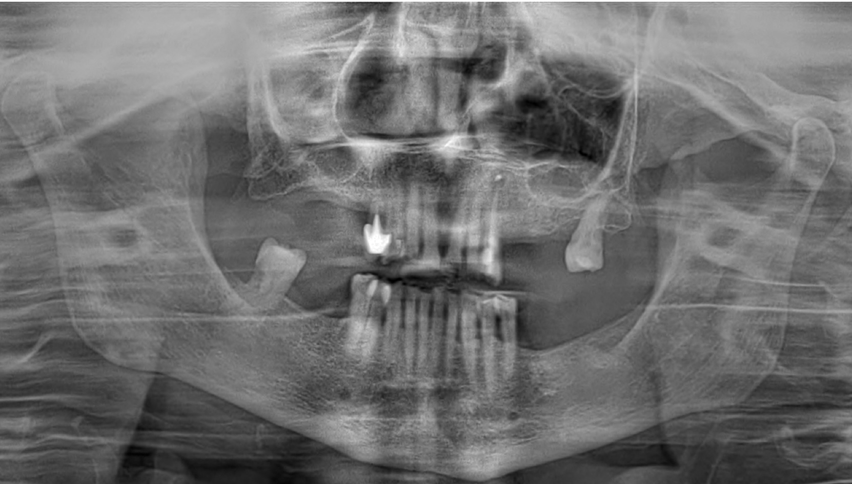 Dental case 5 before treatment